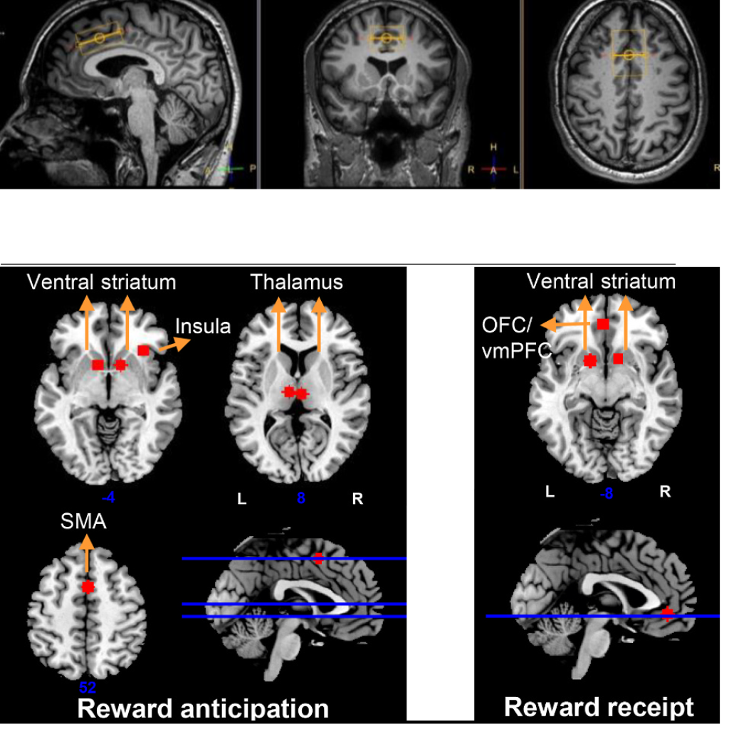 Gehirnscans und CBD